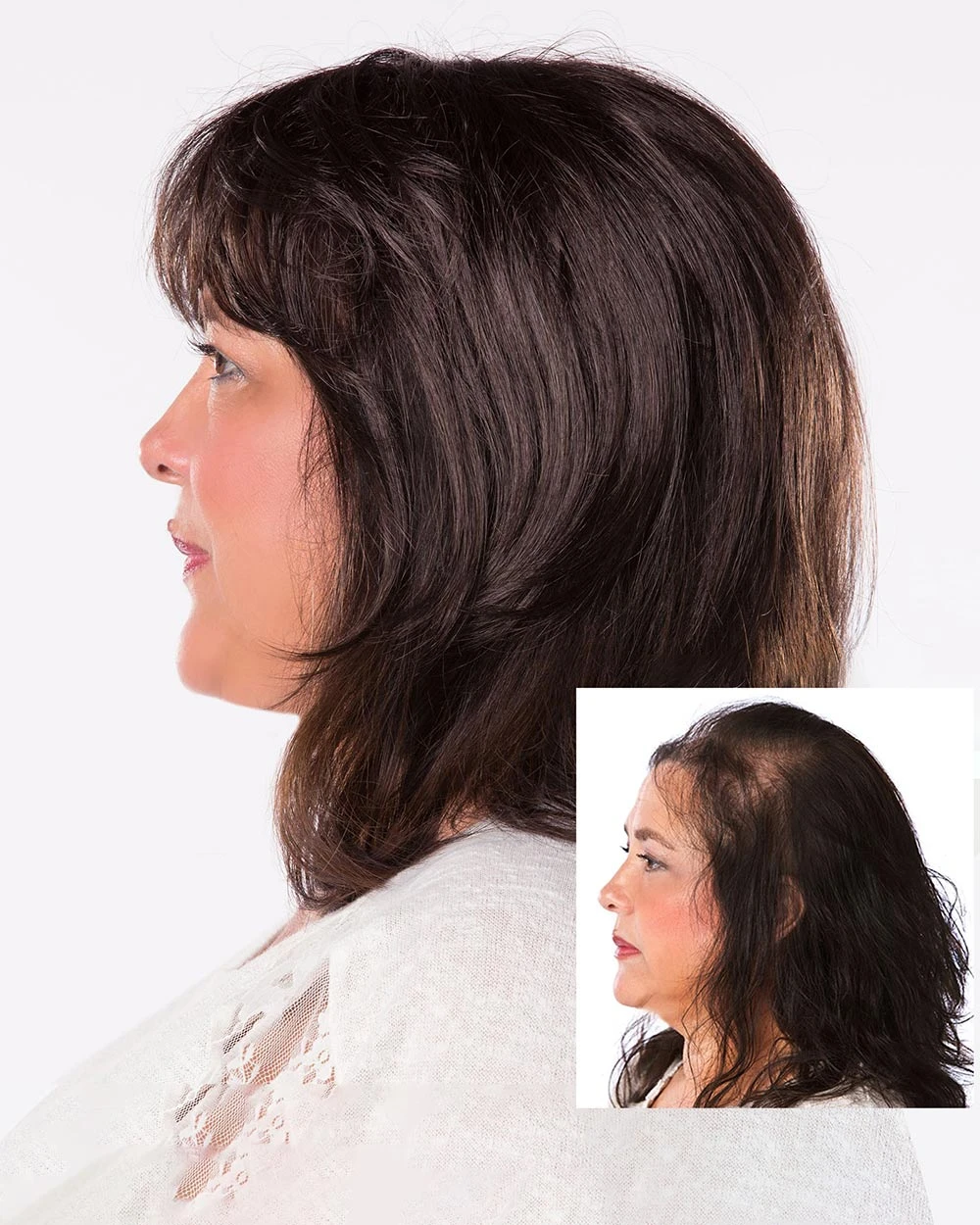 Faux Filler Ultimate Straight Topper HF | Synthetic Hair Wiglet By Toni Brattin - Image 2