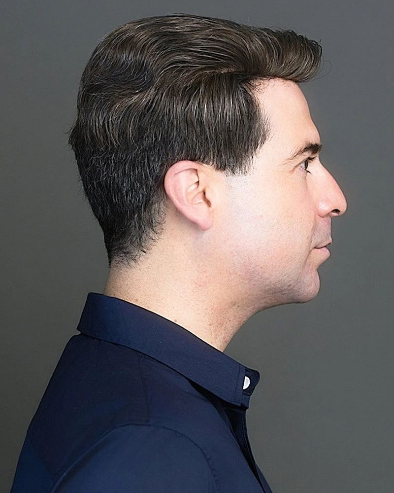 401 | Men's Human Hair Toupee By Wig Pro - Image 2